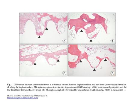 Fig. 1. Differences between old lamellar bone, at a distance >1 mm from the implant surface, and new bone (arrowheads) formation all along the implant.