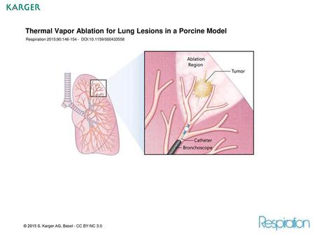 Thermal Vapor Ablation for Lung Lesions in a Porcine Model