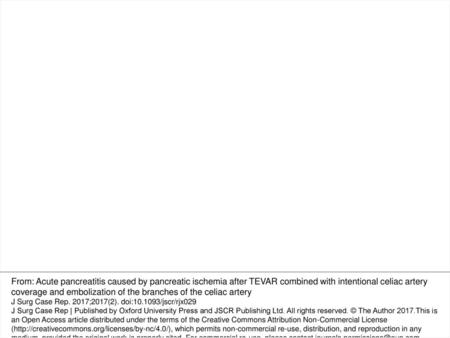 Figure 3: (a and b) Preoperative contrast-eCT