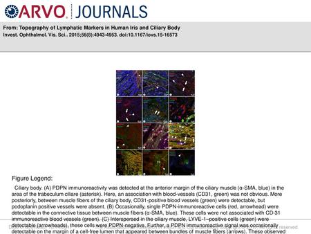 From: Topography of Lymphatic Markers in Human Iris and Ciliary Body