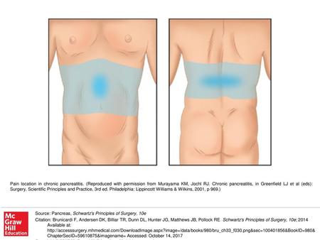 Pain location in chronic pancreatitis