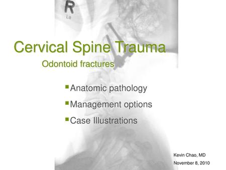 Cervical Spine Trauma Odontoid fractures Anatomic pathology