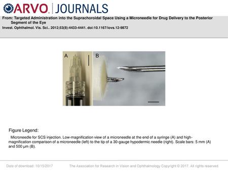 From: Targeted Administration into the Suprachoroidal Space Using a Microneedle for Drug Delivery to the Posterior Segment of the Eye Invest. Ophthalmol.