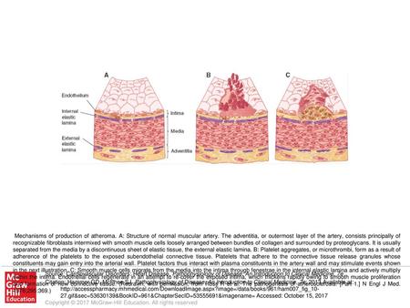 Mechanisms of production of atheroma