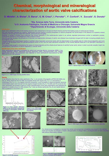 Chemical, morphological and mineralogical characterization of aortic valve calcifications D. Miriello°, A. Bloise°, D. Barca°, G. M. Crisci°, I. Perrotta**,