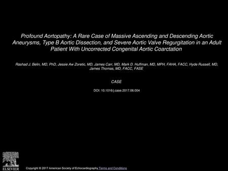 Profound Aortopathy: A Rare Case of Massive Ascending and Descending Aortic Aneurysms, Type B Aortic Dissection, and Severe Aortic Valve Regurgitation.