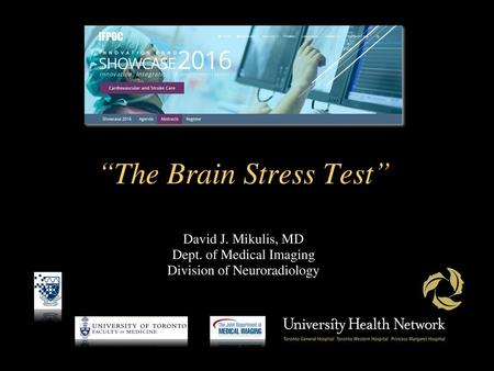 “The Brain Stress Test”