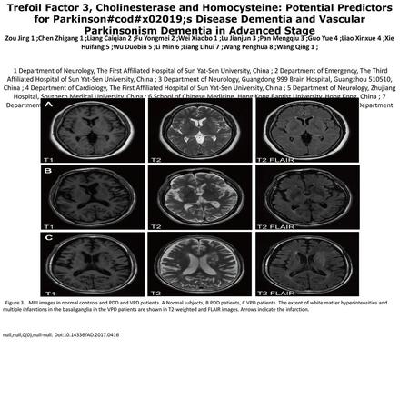 Trefoil Factor 3, Cholinesterase and Homocysteine: Potential Predictors for Parkinson#cod#x02019;s Disease Dementia and Vascular Parkinsonism Dementia.