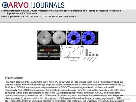 From: Microbead-Induced Ocular Hypertensive Mouse Model for Screening and Testing of Aqueous Production Suppressants for Glaucoma Invest. Ophthalmol. Vis.