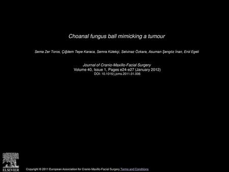 Choanal fungus ball mimicking a tumour