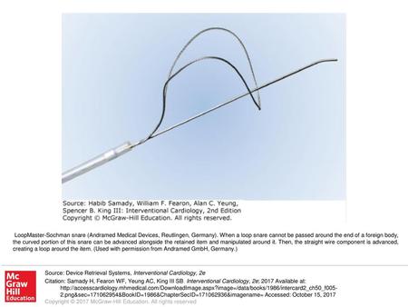 LoopMaster-Sochman snare (Andramed Medical Devices, Reutlingen, Germany). When a loop snare cannot be passed around the end of a foreign body, the curved.