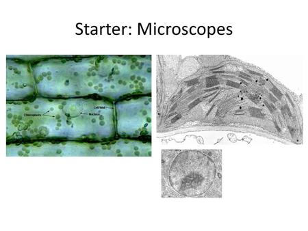 Starter: Microscopes Which image is from the light microsope? How do you know?