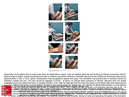 Examination of the patient with an acute knee injury (a) Observation—supine. Look for swelling, deformity and bruising (b) Passive movement—flexion. Assess.