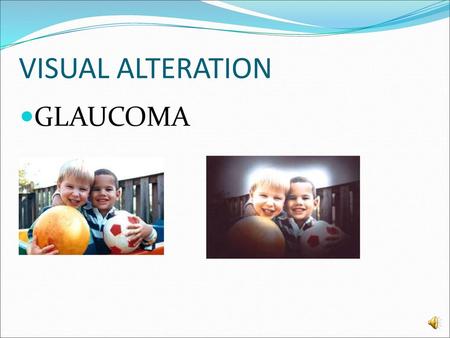 VISUAL ALTERATION GLAUCOMA.