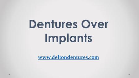 Dentures Over Implants