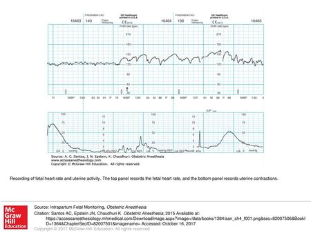 Recording of fetal heart rate and uterine activity