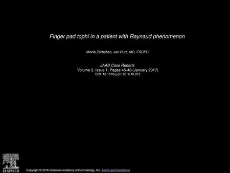 Finger pad tophi in a patient with Raynaud phenomenon