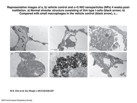 Representative images of a, b) vehicle control and c–f) NiO nanoparticles (NPs) 4 weeks post-instillation. a) Normal alveolar structure consisting of thin.