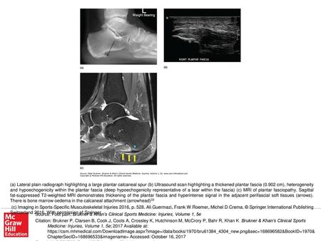 (c) Imaging in Sports-Specific Musculoskeletal Injuries 2016, p. 528