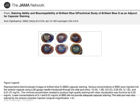 From: Staining Ability and Biocompatibility of Brilliant Blue GPreclinical Study of Brilliant Blue G as an Adjunct for Capsular Staining Arch Ophthalmol.