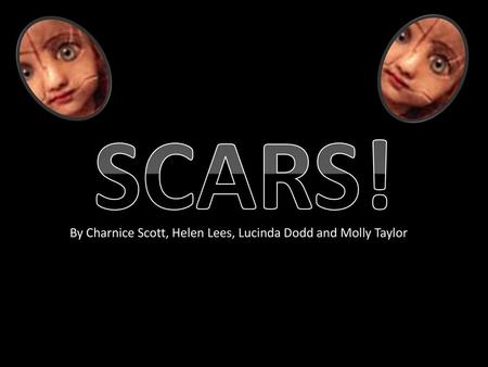 SCARS! By Charnice Scott, Helen Lees, Lucinda Dodd and Molly Taylor.