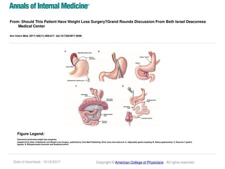 From: Should This Patient Have Weight Loss Surgery