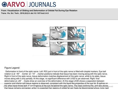 Trans. Vis. Sci. Tech ;5(4):9. doi: /tvst.5.4.9 Figure Legend: