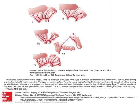 The anatomic spectrum of intestinal atresia