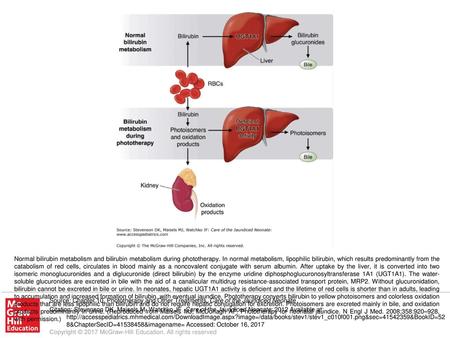 Normal bilirubin metabolism and bilirubin metabolism during phototherapy. In normal metabolism, lipophilic bilirubin, which results predominantly from.