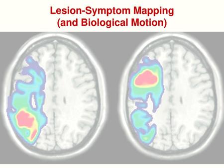 Lesion-Symptom Mapping (and Biological Motion)