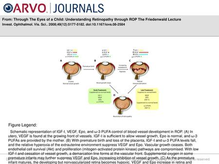 Invest. Ophthalmol. Vis. Sci ;49(12): doi: /iovs Figure Legend: