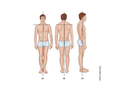 SCOLIOTIC CURVE CAN YOU NAME SOME MUSCLES THAT ARE OVERSTRETCHED?