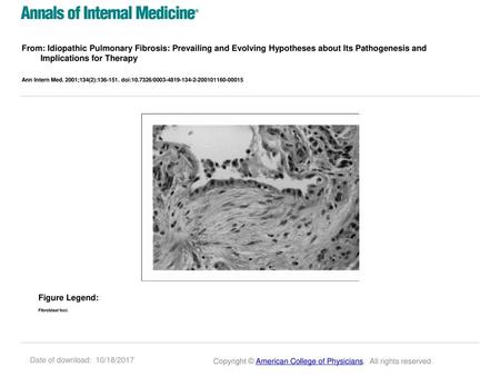 From: Idiopathic Pulmonary Fibrosis: Prevailing and Evolving Hypotheses about Its Pathogenesis and Implications for Therapy Ann Intern Med. 2001;134(2):136-151.