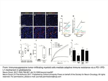 Fig. 1 GBM TIMs expand to inhibit vaccine-induced T-cell mediated tumor cytolysis via PD-1/PD-L1 regulatory pathway. (A, D) CD163, DAPI, (B, E) PD-L1,