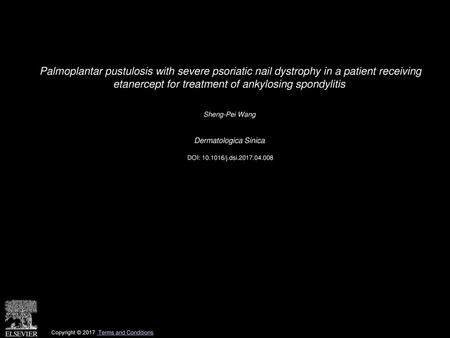 Palmoplantar pustulosis with severe psoriatic nail dystrophy in a patient receiving etanercept for treatment of ankylosing spondylitis  Sheng-Pei Wang 