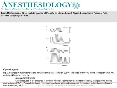 From: Mechanisms of Direct Inhibitory Action of Propofol on Uterine Smooth Muscle Contraction in Pregnant Rats Anesthes. 2001;95(5):1245-1255. Figure Legend: