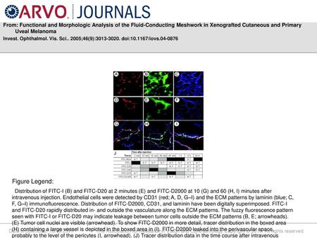 From: Functional and Morphologic Analysis of the Fluid-Conducting Meshwork in Xenografted Cutaneous and Primary Uveal Melanoma Invest. Ophthalmol. Vis.