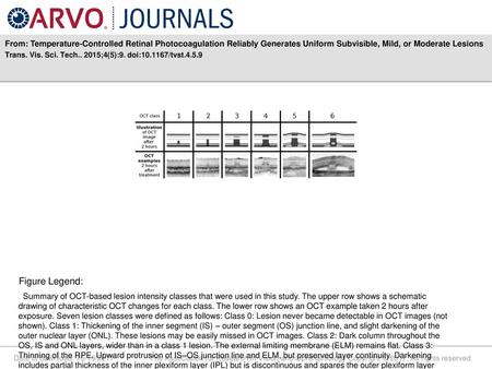 From: Temperature-Controlled Retinal Photocoagulation Reliably Generates Uniform Subvisible, Mild, or Moderate Lesions Trans. Vis. Sci. Tech.. 2015;4(5):9.