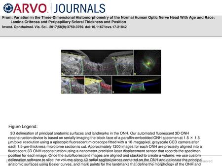 From: Variation in the Three-Dimensional Histomorphometry of the Normal Human Optic Nerve Head With Age and Race: Lamina Cribrosa and Peripapillary Scleral.