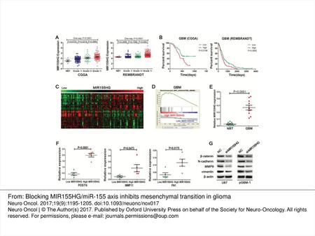 Fig. 1 Increased MIR155HG expression correlates with glioma grade and mesenchymal transition and confers a poor prognosis in GBM patients. (A) The level.