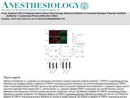 From: Systemic QX-314 Reduces Bone Cancer Pain through Selective Inhibition of Transient Receptor Potential Vanilloid Subfamily 1–expressing Primary Afferents.