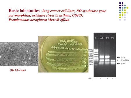 Basic lab studies : lung cancer cell lines, NO synthetase gene