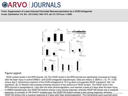 Invest. Ophthalmol. Vis. Sci ;54(2): doi: /iovs Figure Legend: