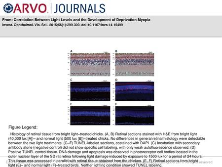 Invest. Ophthalmol. Vis. Sci ;56(1): doi: /iovs Figure Legend: