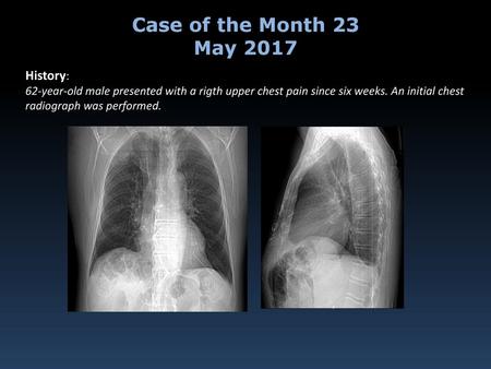 Case of the Month 23 May 2017 History: