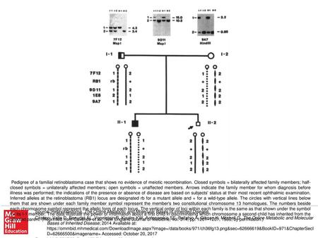 Pedigree of a familial retinoblastoma case that shows no evidence of meiotic recombination. Closed symbols = bilaterally affected family members; half-closed.