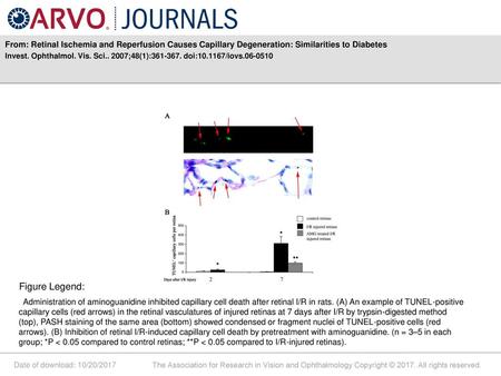 Invest. Ophthalmol. Vis. Sci ;48(1): doi: /iovs Figure Legend: