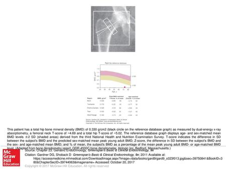 This patient has a total hip bone mineral density (BMD) of 0