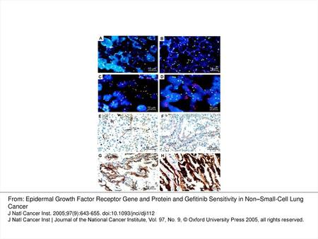 Fig. 1. EGFR content as determined by fluorescence in situ hybridization (FISH) and immunohistochemical staining. FISH was performed with the EGFR ( red.