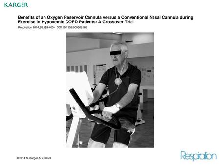 Benefits of an Oxygen Reservoir Cannula versus a Conventional Nasal Cannula during Exercise in Hypoxemic COPD Patients: A Crossover Trial Respiration 2014;88:399-405.